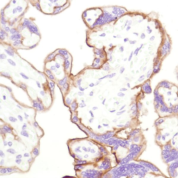 Immunohistochemistry (Formalin/PFA-fixed paraffin-embedded sections) - Anti-CD10 antibody [SP179] - BSA and Azide free (ab243934), expandable thumbnail