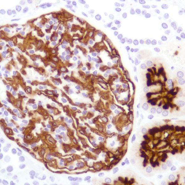 Immunohistochemistry (Formalin/PFA-fixed paraffin-embedded sections) - Anti-CD10 antibody [SP179] - BSA and Azide free (ab243934), expandable thumbnail