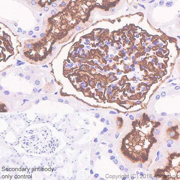Immunohistochemistry (Formalin/PFA-fixed paraffin-embedded sections) - Anti-CD10 antibody [SP179] - BSA and Azide free (AB243934), expandable thumbnail