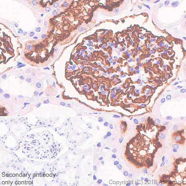 Immunohistochemistry (Formalin/PFA-fixed paraffin-embedded sections) - Anti-CD10 antibody [SP179] - BSA and Azide free (AB243934)