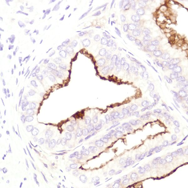 Immunohistochemistry (Formalin/PFA-fixed paraffin-embedded sections) - Anti-CD10 antibody [SP179] - BSA and Azide free (ab243934), expandable thumbnail