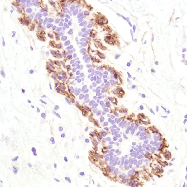 Immunohistochemistry (Formalin/PFA-fixed paraffin-embedded sections) - Anti-CD10 antibody [SP179] - BSA and Azide free (ab243934), expandable thumbnail