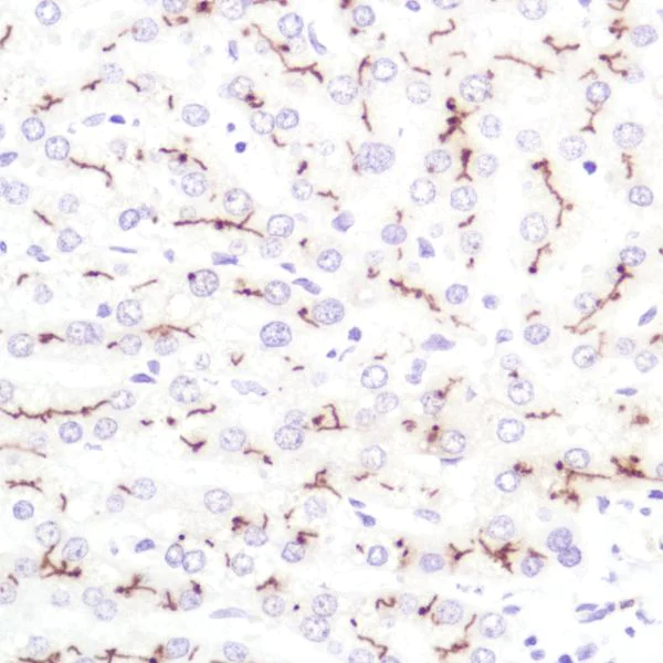 Immunohistochemistry (Formalin/PFA-fixed paraffin-embedded sections) - Anti-CD10 antibody [SP179] - N-terminal (AB227659)