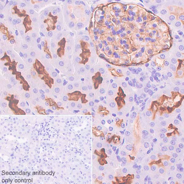 Immunohistochemistry (Formalin/PFA-fixed paraffin-embedded sections) - Anti-CD10 antibody [SP179] - N-terminal (AB227659)