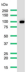 Western blot - Anti-CD10 antibody [SP179] - N-terminal (AB227659)