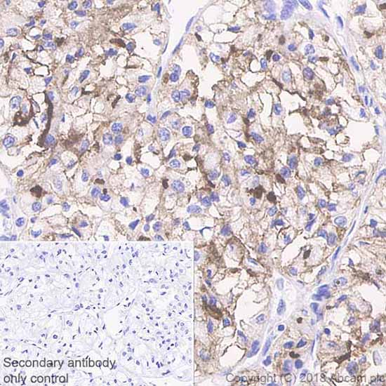 Immunohistochemistry (Formalin/PFA-fixed paraffin-embedded sections) - Anti-CD10 antibody [SP67] (AB227640), expandable thumbnail