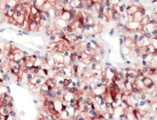 Immunohistochemistry (Formalin/PFA-fixed paraffin-embedded sections) - Anti-CD10 antibody [SP67] - BSA and Azide free (AB236235)
