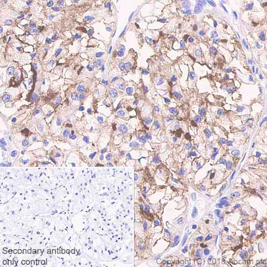 Immunohistochemistry (Formalin/PFA-fixed paraffin-embedded sections) - Anti-CD10 antibody [SP67] - BSA and Azide free (AB236235)