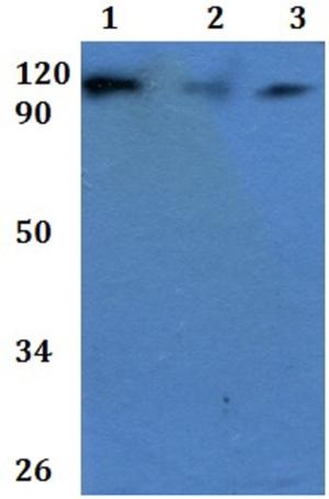 Western blot - Anti-CD101 antibody (AB201084)