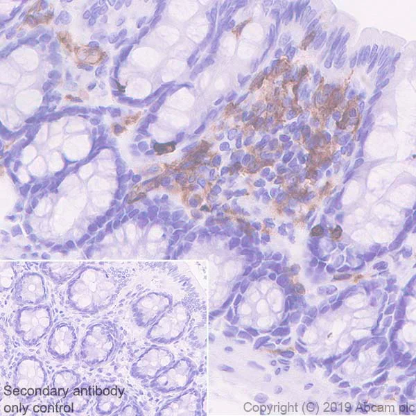 Immunohistochemistry (Formalin/PFA-fixed paraffin-embedded sections) - Anti-CD103 antibody [EPR22590-27] (AB224202)