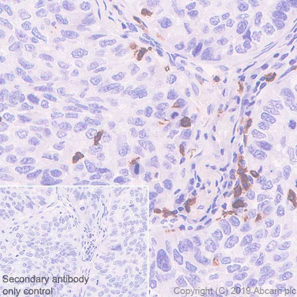 Immunohistochemistry (Formalin/PFA-fixed paraffin-embedded sections) - Anti-CD103 antibody [EPR22590-27] (AB224202)