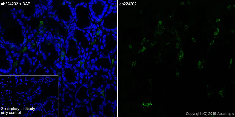 Immunohistochemistry (Frozen sections) - Anti-CD103 antibody [EPR22590-27] (AB224202)