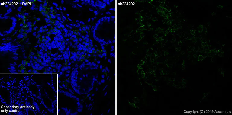 Immunohistochemistry (Frozen sections) - Anti-CD103 antibody [EPR22590-27] (AB224202)