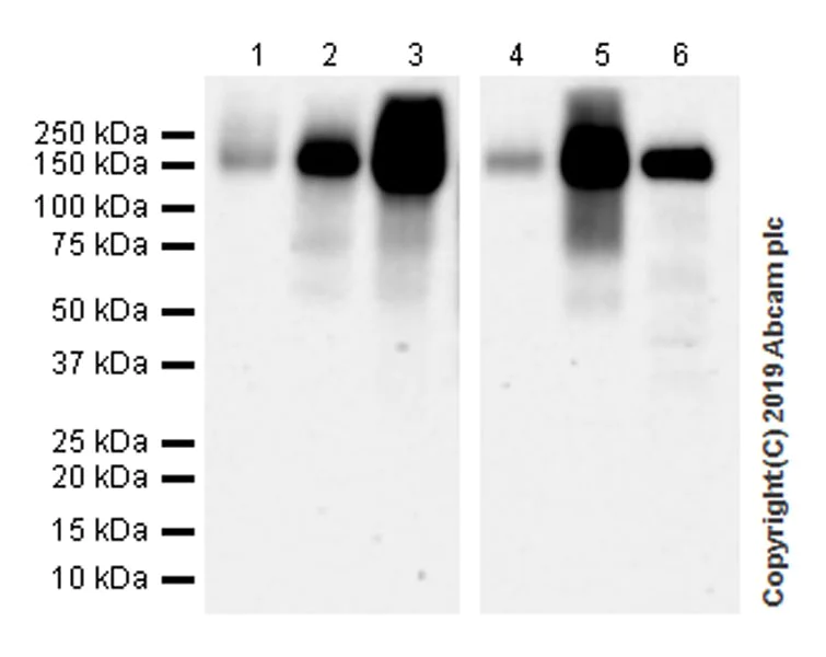Western blot - Anti-CD103 antibody [EPR22590-27] (AB224202)
