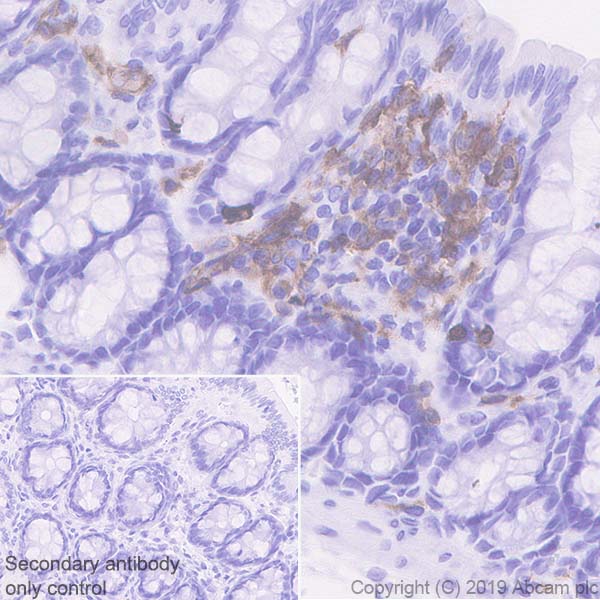 Anti-CD103 antibody [EPR22590-27] - BSA and Azide free