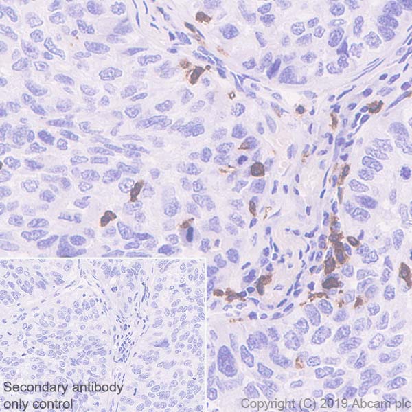 Immunohistochemistry (Formalin/PFA-fixed paraffin-embedded sections) - Anti-CD103 antibody [EPR22590-27] - BSA and Azide free (AB254201)