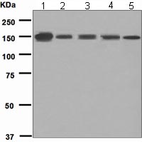 Western blot - Anti-CD103 antibody [EPR4166] (AB108503)