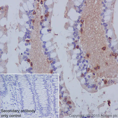 Immunohistochemistry (Formalin/PFA-fixed paraffin-embedded sections) - Anti-CD103 antibody [EPR4166(2)] (AB129202)