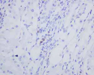Immunohistochemistry (Formalin/PFA-fixed paraffin-embedded sections) - Anti-CD103 antibody [EPR4166(2)] (AB129202)