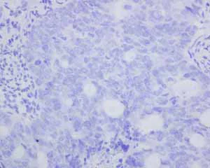 Immunohistochemistry (Formalin/PFA-fixed paraffin-embedded sections) - Anti-CD103 antibody [EPR4166(2)] (AB129202)