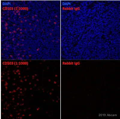 Immunohistochemistry (Formalin/PFA-fixed paraffin-embedded sections) - Anti-CD103 antibody [EPR4166(2)] (AB129202)