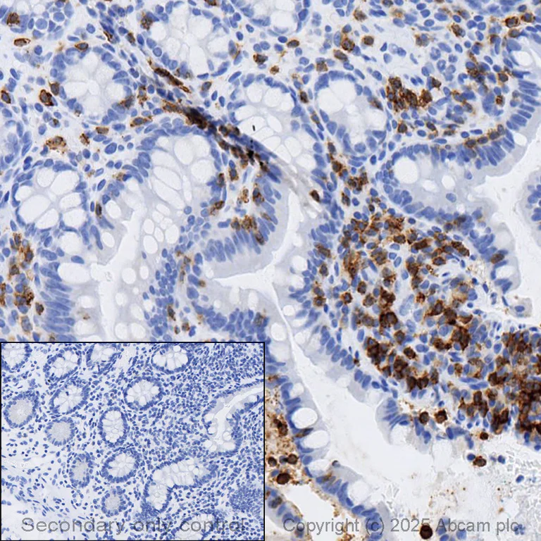 Immunohistochemistry (Formalin/PFA-fixed paraffin-embedded sections) - Anti-CD103 antibody [EPR4166(2)] (AB129202)