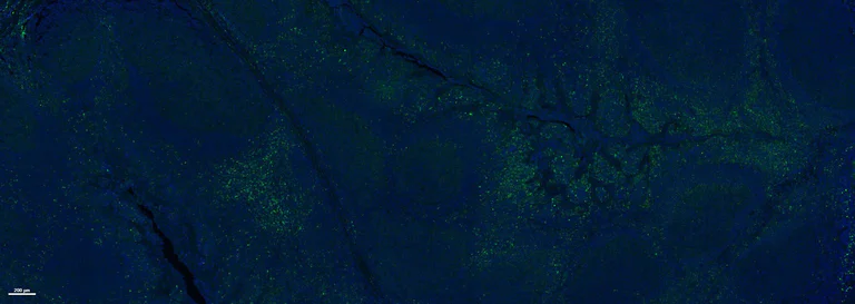 Immunohistochemistry (Formalin/PFA-fixed paraffin-embedded sections) - Anti-CD103 antibody [EPR4166(2)] (AB129202)