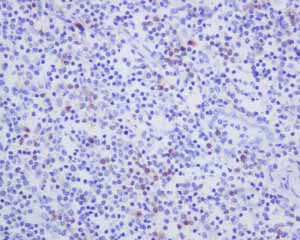 Immunohistochemistry (Formalin/PFA-fixed paraffin-embedded sections) - Anti-CD103 antibody [EPR4166(2)] - BSA and Azide free (AB271889)