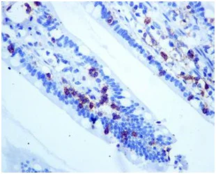 Immunohistochemistry (Formalin/PFA-fixed paraffin-embedded sections) - Anti-CD103 antibody [EPR4166(2)] - BSA and Azide free (AB271889)