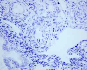 Immunohistochemistry (Formalin/PFA-fixed paraffin-embedded sections) - Anti-CD103 antibody [EPR4166(2)] - Low endotoxin, Azide free (AB221210)