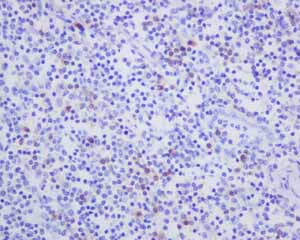 Immunohistochemistry (Formalin/PFA-fixed paraffin-embedded sections) - Anti-CD103 antibody [EPR4166(2)] - Low endotoxin, Azide free (AB221210)