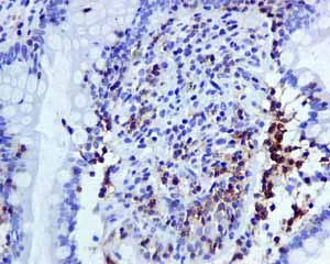 Immunohistochemistry (Formalin/PFA-fixed paraffin-embedded sections) - Anti-CD103 antibody [EPR4166(2)] - Low endotoxin, Azide free (AB221210)