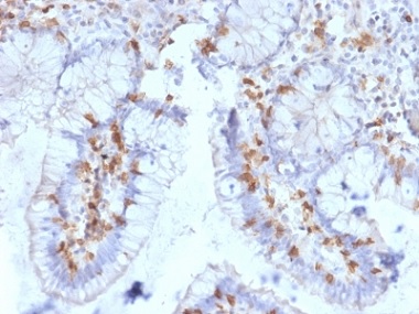 Immunohistochemistry (Formalin/PFA-fixed paraffin-embedded sections) - Anti-CD103 antibody [ITGAE/2063] - BSA and Azide free (AB237854), expandable thumbnail