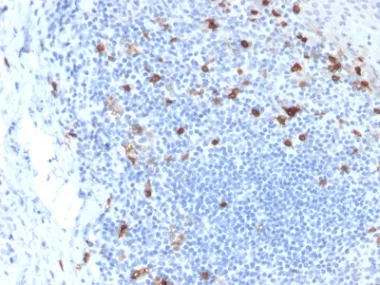 Immunohistochemistry (Formalin/PFA-fixed paraffin-embedded sections) - Anti-CD103 antibody [ITGAE/2063] - BSA and Azide free (AB237854)
