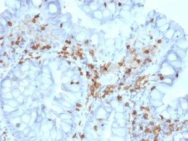 Immunohistochemistry (Formalin/PFA-fixed paraffin-embedded sections) - Anti-CD103 antibody [ITGAE/2063] - BSA and Azide free (AB237854)