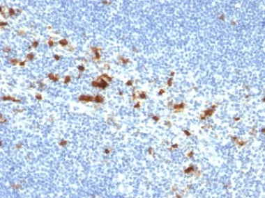 Immunohistochemistry (Formalin/PFA-fixed paraffin-embedded sections) - Anti-CD103 antibody [ITGAE/2474] - BSA and Azide free (AB237855)