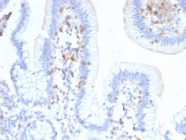 Immunohistochemistry (Formalin/PFA-fixed paraffin-embedded sections) - Anti-CD103 antibody [ITGAE/2474] - BSA and Azide free (AB237855)
