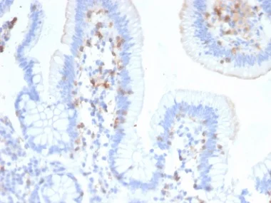Immunohistochemistry (Formalin/PFA-fixed paraffin-embedded sections) - Anti-CD103 antibody [ITGAE/2474] - BSA and Azide free (AB237855)