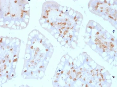 Immunohistochemistry (Formalin/PFA-fixed paraffin-embedded sections) - Anti-CD103 antibody [ITGAE/2474] - BSA and Azide free (AB237855)