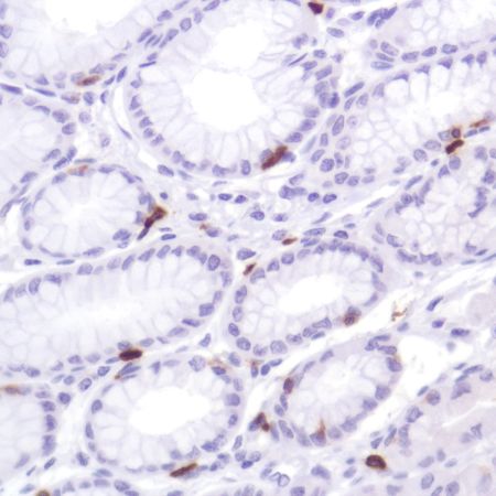 Immunohistochemistry (Formalin/PFA-fixed paraffin-embedded sections) - Anti-CD103 antibody [SP301] (ab227697), expandable thumbnail