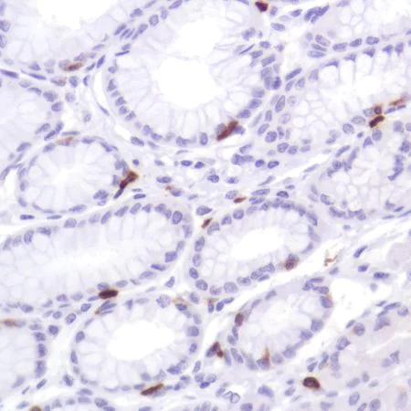 Immunohistochemistry (Formalin/PFA-fixed paraffin-embedded sections) - Anti-CD103 antibody [SP301] (AB227697)