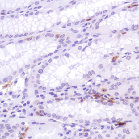 Immunohistochemistry (Formalin/PFA-fixed paraffin-embedded sections) - Anti-CD103 antibody [SP301] (ab227697), expandable thumbnail