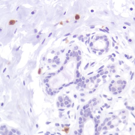Immunohistochemistry (Formalin/PFA-fixed paraffin-embedded sections) - Anti-CD103 antibody [SP301] (ab227697), expandable thumbnail
