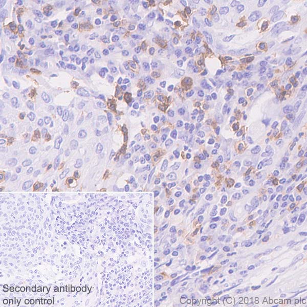Immunohistochemistry (Formalin/PFA-fixed paraffin-embedded sections) - Anti-CD103 antibody [SP301] (AB227697), expandable thumbnail