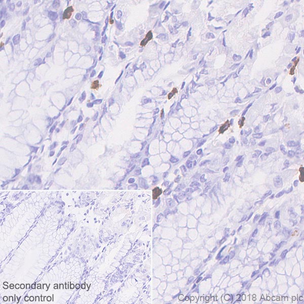 Immunohistochemistry (Formalin/PFA-fixed paraffin-embedded sections) - Anti-CD103 antibody [SP301] (AB227697), expandable thumbnail