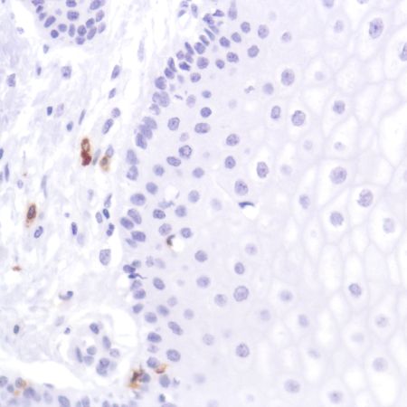 Immunohistochemistry (Formalin/PFA-fixed paraffin-embedded sections) - Anti-CD103 antibody [SP301] (ab227697), expandable thumbnail