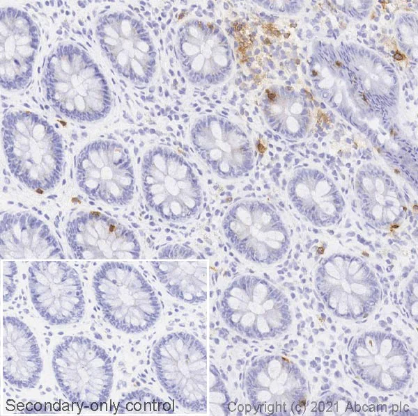 Immunohistochemistry (Frozen sections) - Anti-CD103 antibody [SP301] (AB227697)