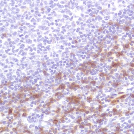 Immunohistochemistry (Formalin/PFA-fixed paraffin-embedded sections) - Anti-CD103 antibody [SP301] - BSA and Azide free (AB245746)