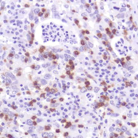 Immunohistochemistry (Formalin/PFA-fixed paraffin-embedded sections) - Anti-CD103 antibody [SP301] - BSA and Azide free (AB245746)