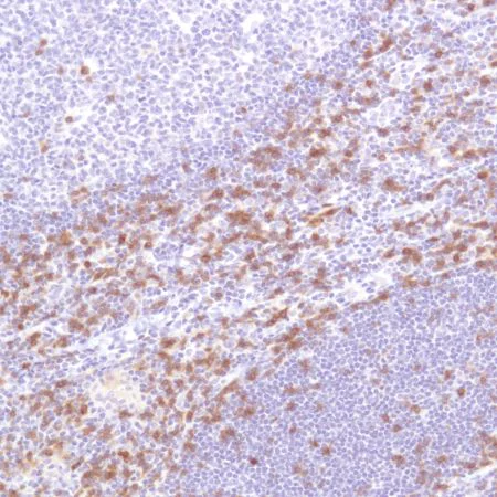 Immunohistochemistry (Formalin/PFA-fixed paraffin-embedded sections) - Anti-CD103 antibody [SP301] - BSA and Azide free (AB245746)